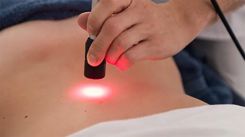 laserterapia